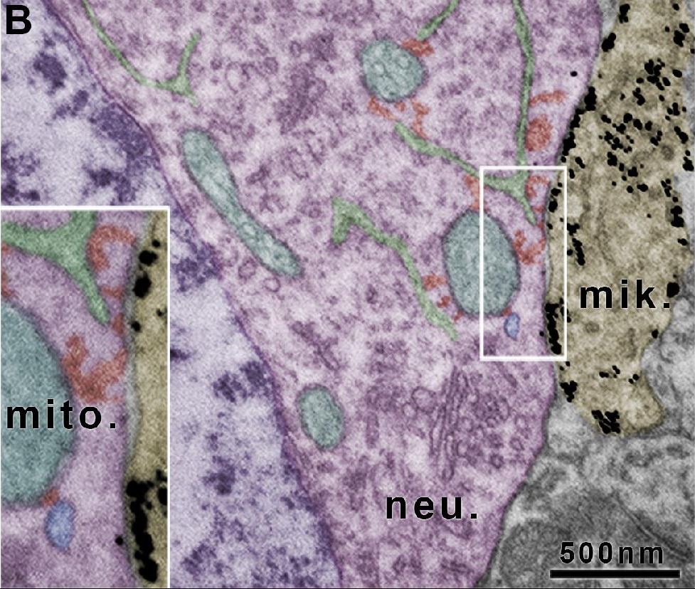 Az elektronmikroszkópos felvételen is jól kivehetőek a különleges kapcsolat elemei, a mitokondriumok (mito., türkiz), a mitokondrium-kapcsolt membrán (zöld), a horgonyzóstruktúrák (piros), és a vezikulák (kék). A fekete szemcsék felhalmozódása a mikrogliális P2Y12-receptorokat jelöli. Forrás:  Kísérleti Orvostudományi Kutatóintézet
