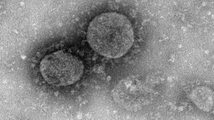 A megfázást okozó vírus képes legyőzni az új koronavírust