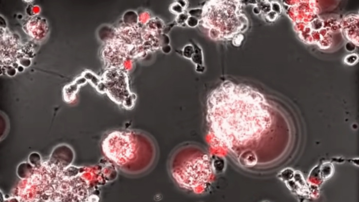 Így pusztít a koronavírus az agyban – videó