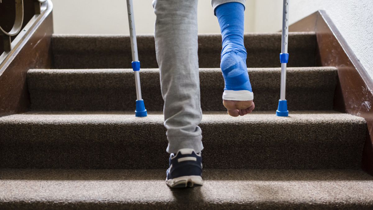 A young adult with crutches and his foot bandaged in plaster is ascending steps of a stairway inside an apartment house. Barefoot toes are sticking out of bandage.