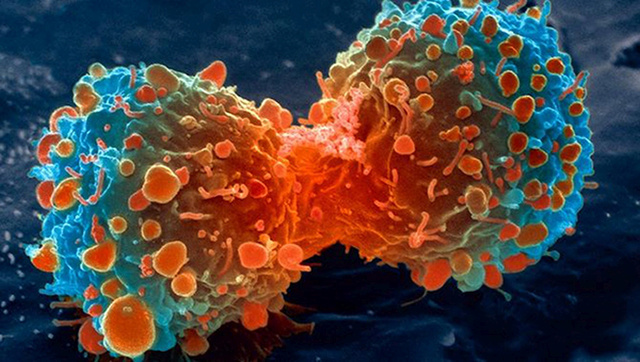 A rákos sejtek ellenállási trükkjeit vizsgálják