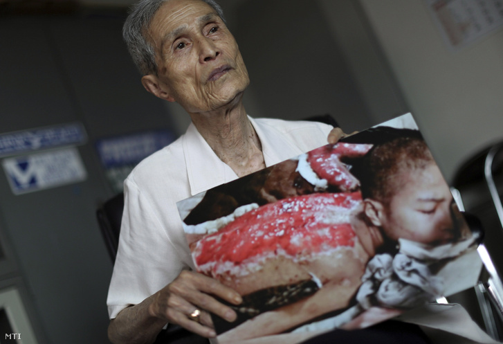 Meghalt a nagaszaki atomcsapás világhírűvé vált túlélője - emlékszik a drámai fotóra?