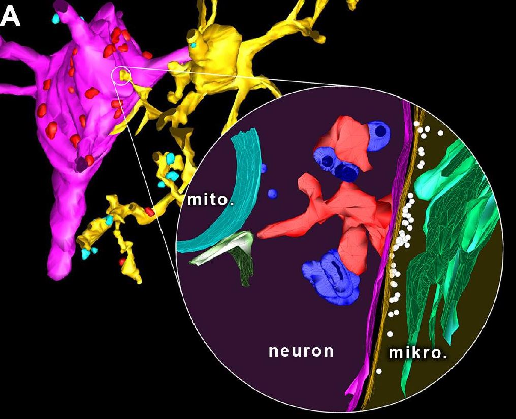 Fénymikroszkópos (balra) és elektron-tomográfiás (jobbra, kinagyított rész) felvétel alapján készült 3D-rekonstrukció mutatja az újonnnan felfedezett mikroglia (okker) – neuron (magenta) szomatikus kapcsolat szerkezetét. Forrás: Kísérleti Orvostudományi Kutatóintézet.
