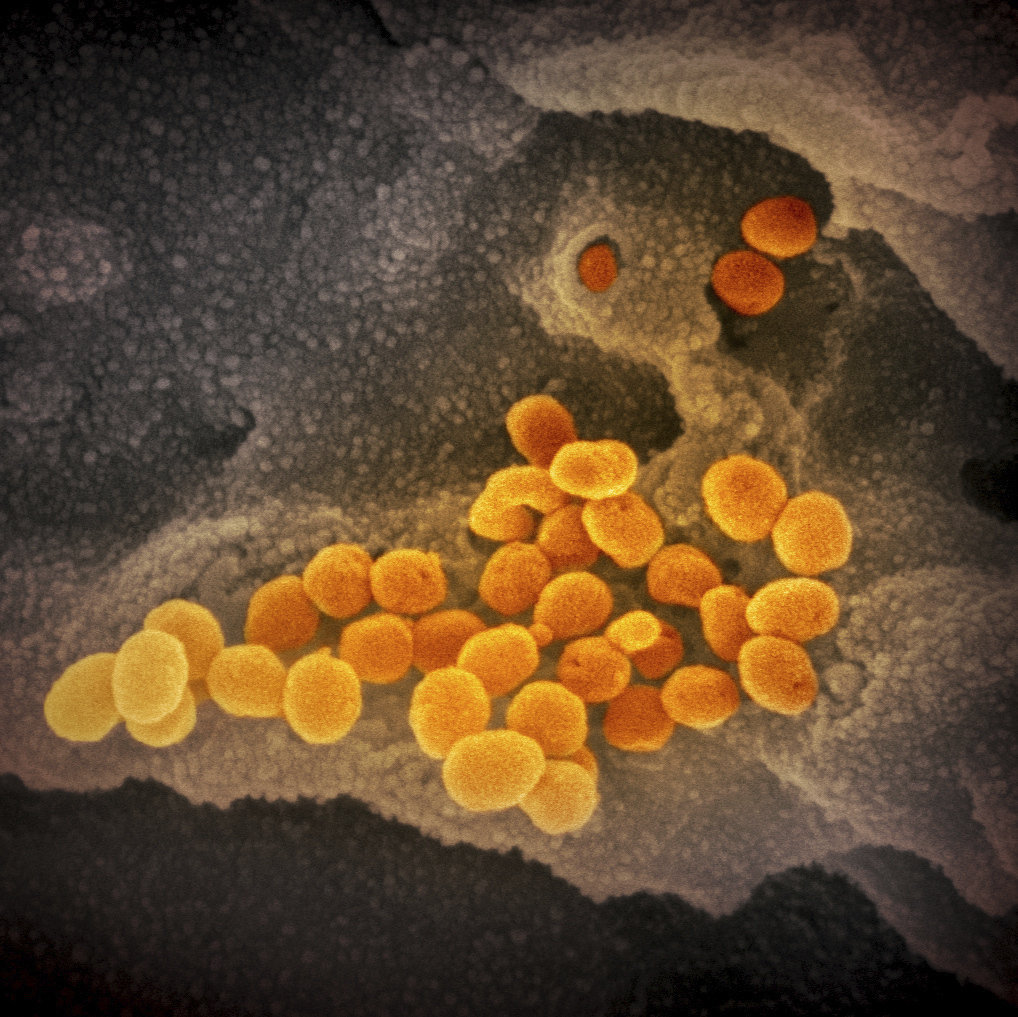 Hamilton, 2020. február 17.
Az amerikai Allergiás és Fertőző Betegségek Országos Intézete (NIAID) által közreadott,  dátumozatlan elektronmikroszkópos kép a SARS-CoV-2 nevű koronavírusról, amint laboratóriumban tenyésztve a narancsárga színű kórokozó előtör a környező sejtből. A 2019-nCoV néven is ismert vírus egy fertőző humán koronavírus, amely a COVID-19-nek nevezett, tüdőgyulladásos megbetegedést okozza. A mintát egy betegtől vették az Egyesült Államokban. A COVID-19-nek elnevezett újfajta koronavírus előidézte betegség halálos áldozatainak száma 1776-ra emelkedett Kínában, a legtöbben a járvány gócpontjában, Hupej tartomány székhelyén, Vuhanban hunytak el. A 2019 december közepe óta tomboló járvány fertőzöttjeinek száma 70 548-ra nőtt.
MTI/AP/NIAID-RML