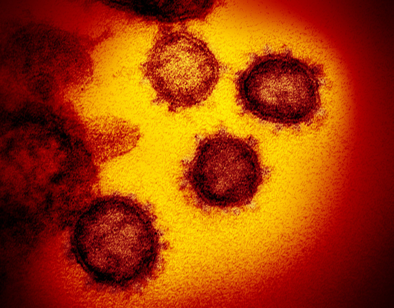 Hamilton, 2020. február 17.
Az amerikai Allergiás és Fertőző Betegségek Országos Intézete (NIAID) által közreadott,  dátumozatlan elektronmikroszkópos kép a SARS-CoV-2 nevű koronavírusról. A 2019-nCoV néven is ismert vírus egy fertőző humán koronavírus, amely a COVID-19-nek nevezett, tüdőgyulladásos megbetegedést okozza. A mintát egy betegtől vették az Egyesült Államokban. A COVID-19-nek elnevezett újfajta koronavírus előidézte betegség halálos áldozatainak száma 1776-ra emelkedett Kínában, a legtöbben a járvány gócpontjában, Hupej tartomány székhelyén, Vuhanban hunytak el. A 2019 december közepe óta tomboló járvány fertőzöttjeinek száma 70 548-ra nőtt.
MTI/AP/NIAID-RML