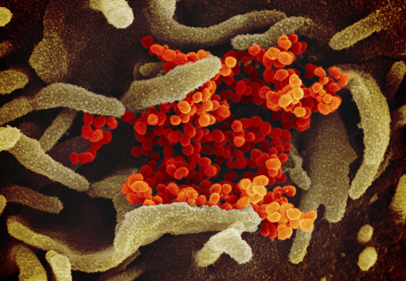 Egyesült Államok, 2020. február 15.
Az amerikai Allergiás és Fertőző Betegségek Országos Intézete (NIAID) által közreadott, keltezetlen elektronmikroszkópos felvétel a tüdőgyulladást okozó új koronavírusról, amint a laboratóriumban tenyésztett narancsárga színű kórokozó előtör a környező sejtből. A járványt okozó vírust egy amerikai betegből nyerték ki.
MTI/AP/NIAID