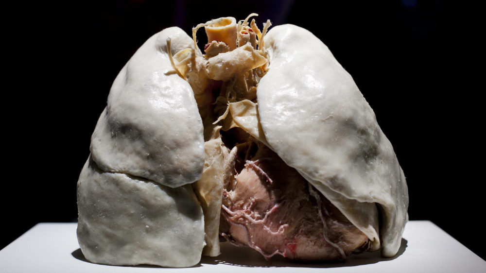 Nemdohányzó ember tüdőpreparátuma az emberi szervezet felépítését, működését bemutató Az emberi test (The Human Body) című kiállításon a Budapesti Értéktőzsde volt épületében, a VÁCI1 üzletházban.