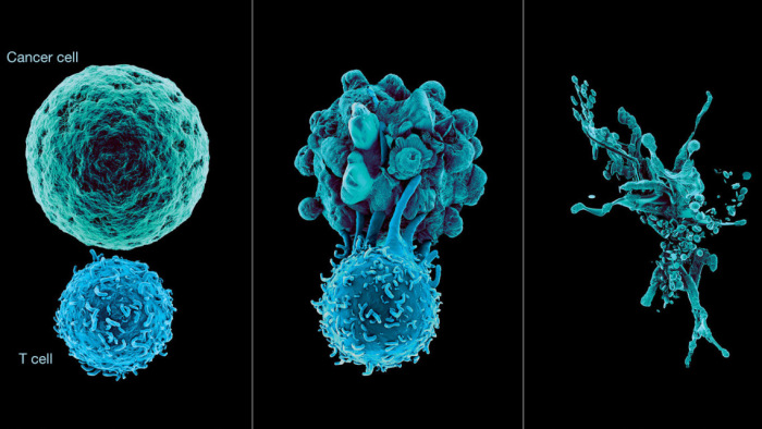 A rákos betegek negyedénél tartós sikert ér el az immunterápia