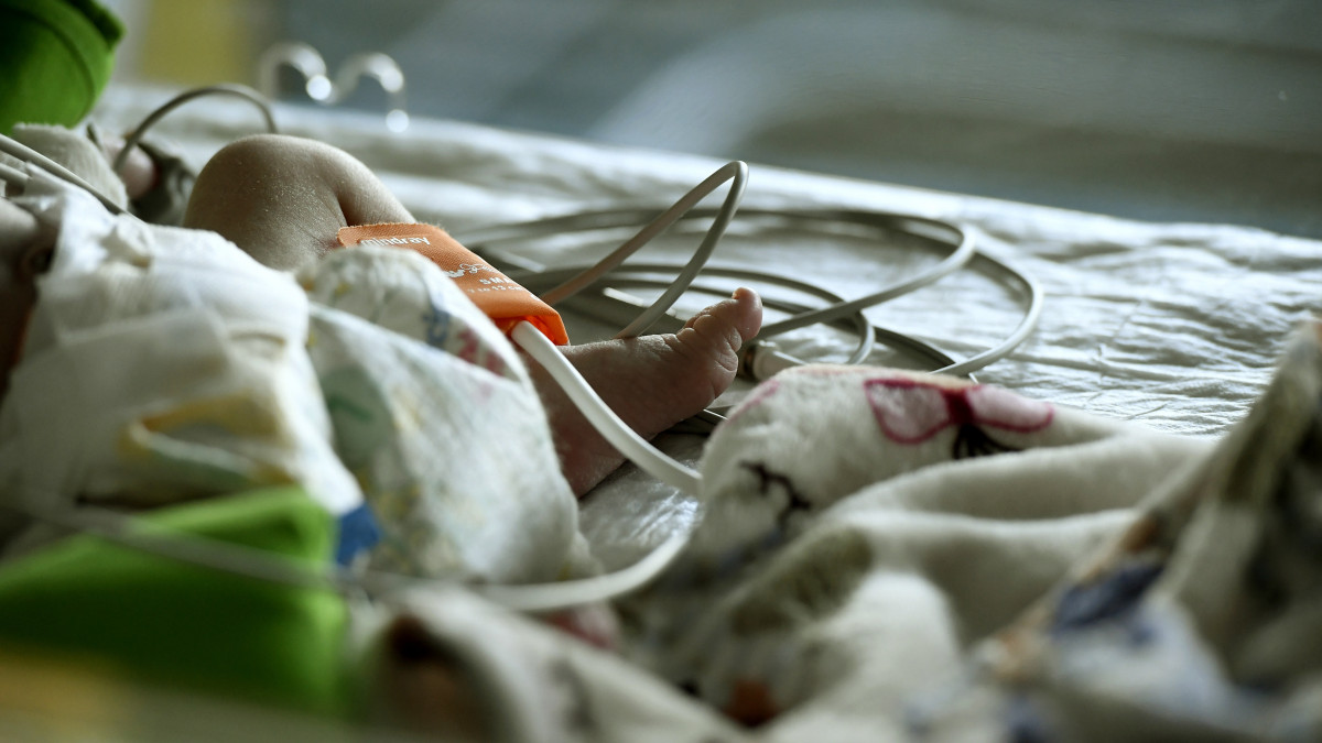 Beteg újszülött a Gottsegen György Országos Kardiológiai Intézet Gyermekszív Központjában 2019. március 20-án. A Down-szindrómások világnapja alkalmából tartott sajtótájékoztatón bejelentették, hogy a Down-szindrómával született gyerekek ma már minden esetben átesnek helyreállító szívműtéten.