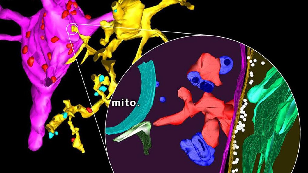 Fénymikroszkópos (balra) és elektron-tomográfiás (jobbra, kinagyított rész) felvétel alapján készült 3D-rekonstrukció mutatja az újonnnan felfedezett mikroglia (okker) – neuron (magenta) szomatikus kapcsolat szerkezetét. Forrás: Kísérleti Orvostudományi Intézet.
