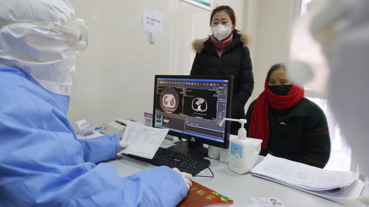 Egy nő tüdeje komputertomográfos vizsgálatának eredményét nézi meg egy orvos a kínai Santung tartományban fekvő Jinan megye egyik kórházában 2020. február 12-én. A koronavírus előidézte tüdőgyulladás halálos áldozatainak száma 1114-re emelkedett Kínában, a legtöbben a járvány gócpontjában, Hupej tartomány székhelyén, Vuhanban hunytak el.