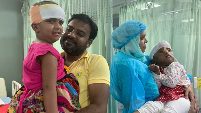 Mindent megmutattak a magyar sebészek, drámai videók a bangladesi ikrekről