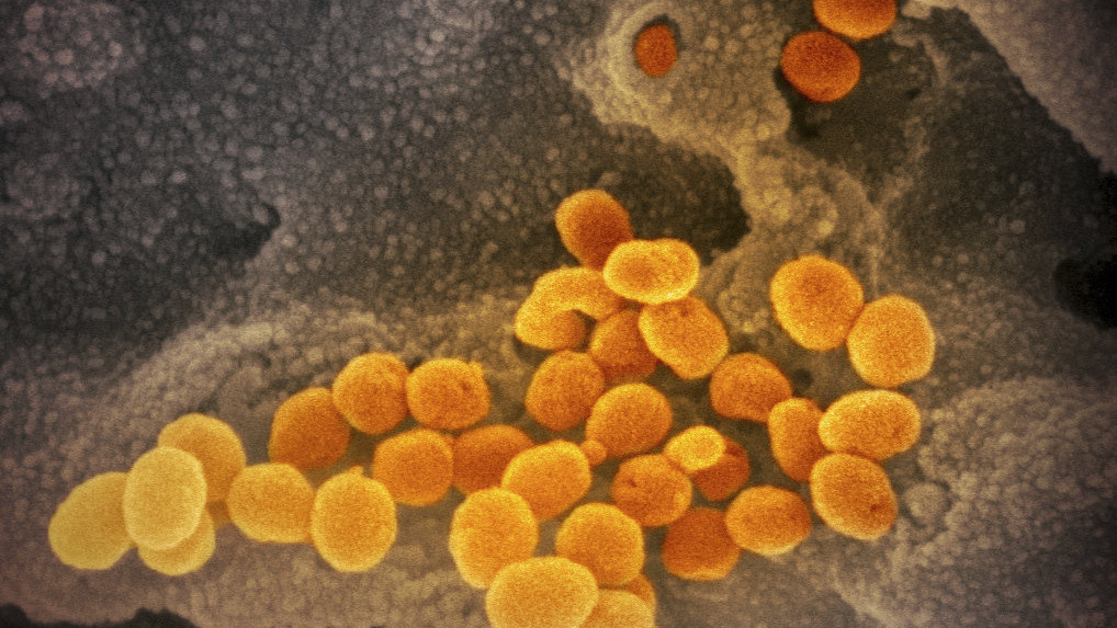 Az amerikai Allergiás és Fertőző Betegségek Országos Intézete (NIAID) által közreadott,  dátumozatlan elektronmikroszkópos kép a SARS-CoV-2 nevű koronavírusról, amint laboratóriumban tenyésztve a narancsárga színű kórokozó előtör a környező sejtből. A 2019-nCoV néven is ismert vírus egy fertőző humán koronavírus, amely a COVID-19-nek nevezett, tüdőgyulladásos megbetegedést okozza. A mintát egy betegtől vették az Egyesült Államokban. A COVID-19-nek elnevezett újfajta koronavírus előidézte betegség halálos áldozatainak száma 1776-ra emelkedett Kínában, a legtöbben a járvány gócpontjában, Hupej tartomány székhelyén, Vuhanban hunytak el. A 2019 december közepe óta tomboló járvány fertőzöttjeinek száma 70 548-ra nőtt.