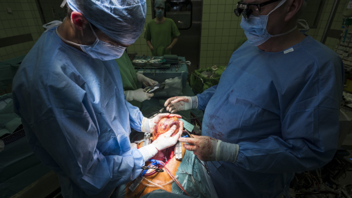 Transzplantációs nagyhatalom lehetünk Európában
