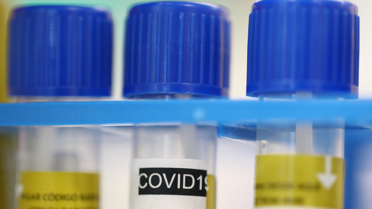 Kémcsövek a svájci Lausanne-i Egyetemi Kórház (CHUV) mikrobiológiai laboratóriumában 2020. március 23-án. Svájcban eddig 8547 koronavírussal fertőzött személyt regisztráltak és 118-an vesztették életüket.