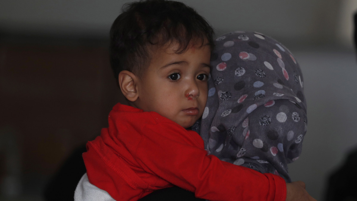 Jemeni kisgyerek orvosi vizsgálatra érkezik anyjával egy egészségügyi központban, Szanaában 2020. április 19-én. Jemenben a 2014-ben kezdődött polgárháború miatt több mint 10 millió gyermek éhezik, közülük legalább kétmillióan súlyosan alultápláltak.