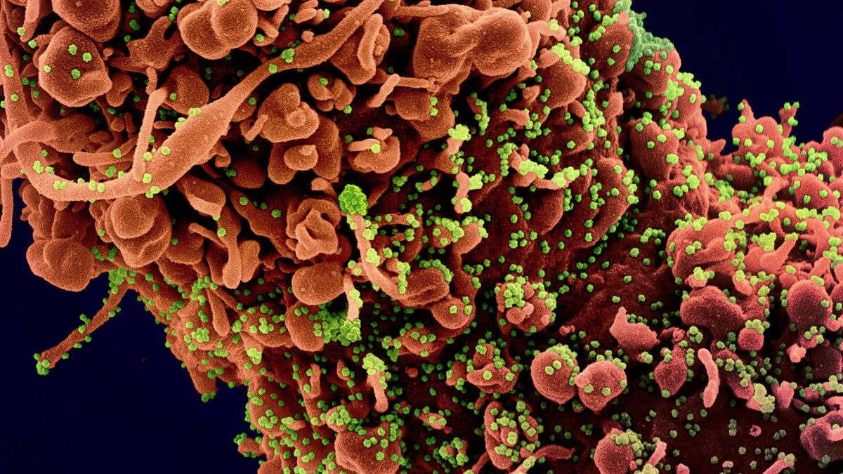 Az amerikai Allergiás és Fertőző Betegségek Országos Intézetében (NIAID) készült, és az amerikai Országos Egészségügyi Intézetek (NIH) által elérhetővé vált, dátumozatlan elektronmikroszkópos, utószínezett kép a SARS-CoV-2 nevű koronavírusról (zöld), és a kórokozó által megtámadott, pusztuló, morfológiai elváltozást mutató emberi sejtekről. A világjárványt okozó vírus mintáját egy betegtől vették.