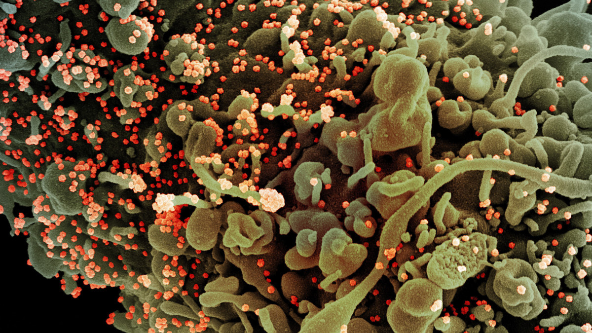 Az amerikai Allergiás és Fertőző Betegségek Országos Intézetében (NIAID) készült, és az amerikai Országos Egészségügyi Intézetek (NIH) által elérhetővé vált, dátumozatlan elektronmikroszkópos, utószínezett kép a SARS-CoV-2 nevű koronavírusról (narancssárga), és a kórokozó által megtámadott, pusztuló, morfológiai elváltozást mutató emberi sejtekről. A világjárványt okozó vírus mintáját egy betegtől vették.