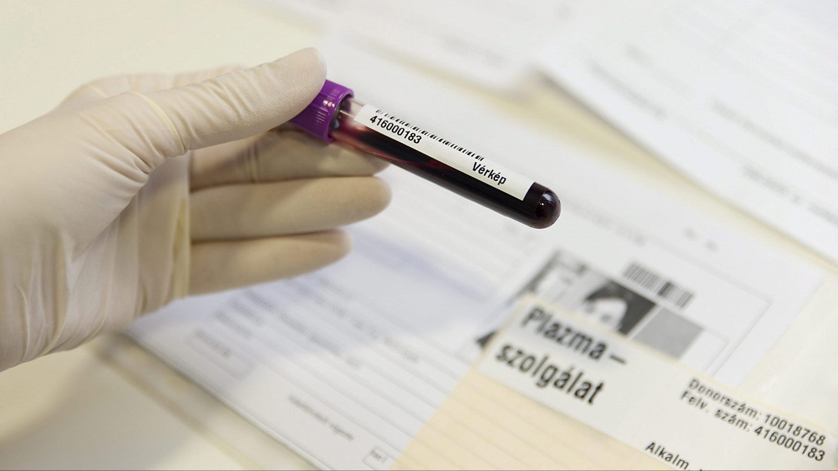 Vért tartalmazó ampulla a győri plazmaferezis-központban 2016. február 8-án. A plazmaferezis emberi vérplazma nyerésére szolgáló eljárás, amely plazmakészítmények előállításához gyógyszeralapanyagul szolgál. Egy speciális készülék segítségével kizárólag a plazma levételére kerül sor, a vér többi sejtkomponensét a donor érrendszerébe visszajuttatja a berendezés.