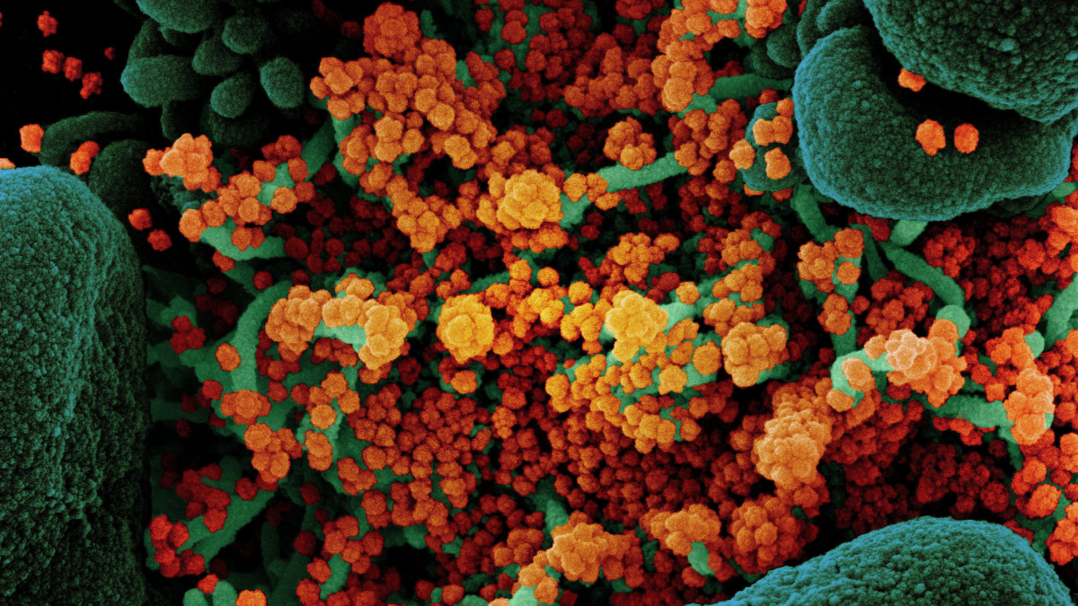 Az amerikai Allergiás és Fertőző Betegségek Országos Intézetében (NIAID) készült, és az amerikai Országos Egészségügyi Intézetek (NIH) által elérhetővé vált, dátumozatlan elektronmikroszkópos, utószínezett kép SARS-CoV-2 nevű koronavírussal (narancssárga) erősen fertőzött, pusztuló (zöld) sejtekről. A világjárványt okozó vírus mintáját egy betegtől vették.