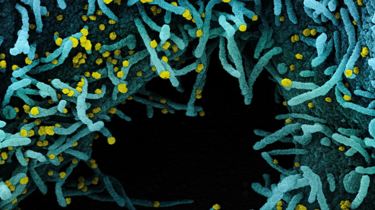 Az amerikai Allergiás és Fertőző Betegségek Országos Intézetében (NIAID) készült, és az amerikai Országos Egészségügyi Intézetek (NIH) által elérhetővé vált, dátumozatlan elektronmikroszkópos, utószínezett kép SARS-CoV-2 nevű koronavírussal (sárga) erősen fertőzött emberi sejtekről. A világjárványt okozó vírus mintáját egy betegtől vették. A fekete színű terület a sejtek közötti tér.