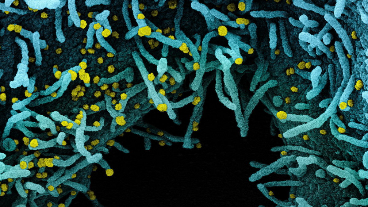 Az amerikai Allergiás és Fertőző Betegségek Országos Intézetében (NIAID) készült, és az amerikai Országos Egészségügyi Intézetek (NIH) által elérhetővé vált, dátumozatlan elektronmikroszkópos, utószínezett kép SARS-CoV-2 nevű koronavírussal (sárga) erősen fertőzött emberi sejtekről. A világjárványt okozó vírus mintáját egy betegtől vették. A fekete színű terület a sejtek közötti tér.