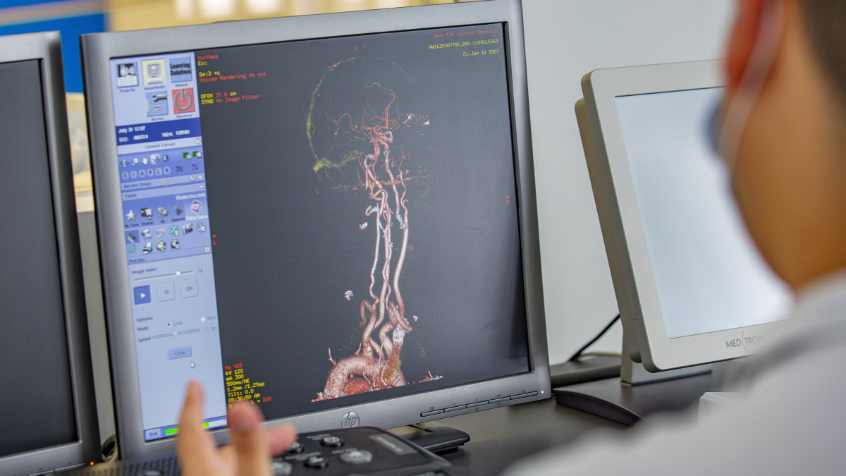 Érrendszer képe a Pécsi Tudományegyetem Klinikai Központ új, csúcskategóriás CT-berendezésének monitorján az ünnepélyes átadás napján, 2020. július 31-én.