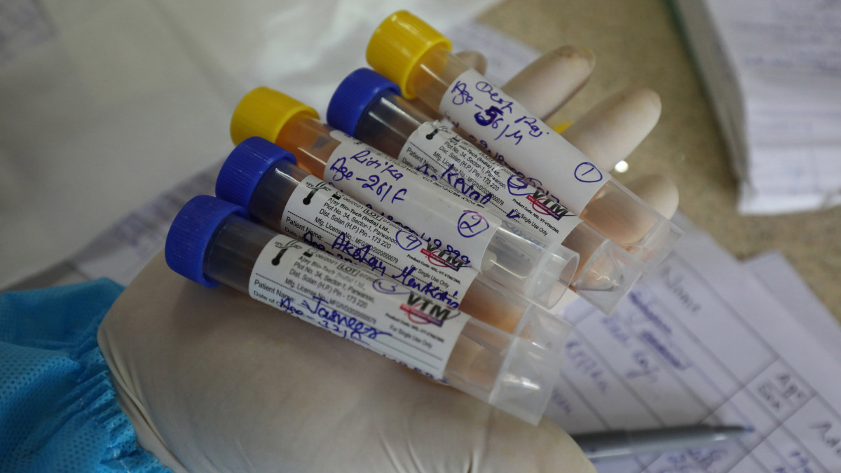 Koronavírus-teszthez levett mintákat tartalmazó kapszulák egy kórházban az indiai Dharamszalában 2020. szeptember 4-én. Indiában eddig 3 993 412-en fertőződtek meg az új típusú koronavírussal, az elmúlt 24 órában 60 288-ra emelkedett a koronavírusos esetek száma.