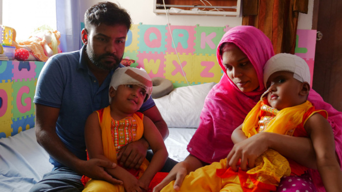 Bangladesi sziámi ikrek: két év után hazatér az egész család