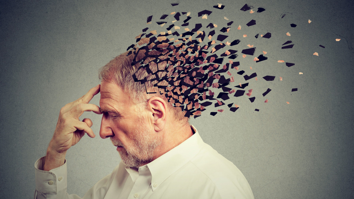 Memory loss due to dementia. Senior man losing parts of head  as symbol of decreased mind function.