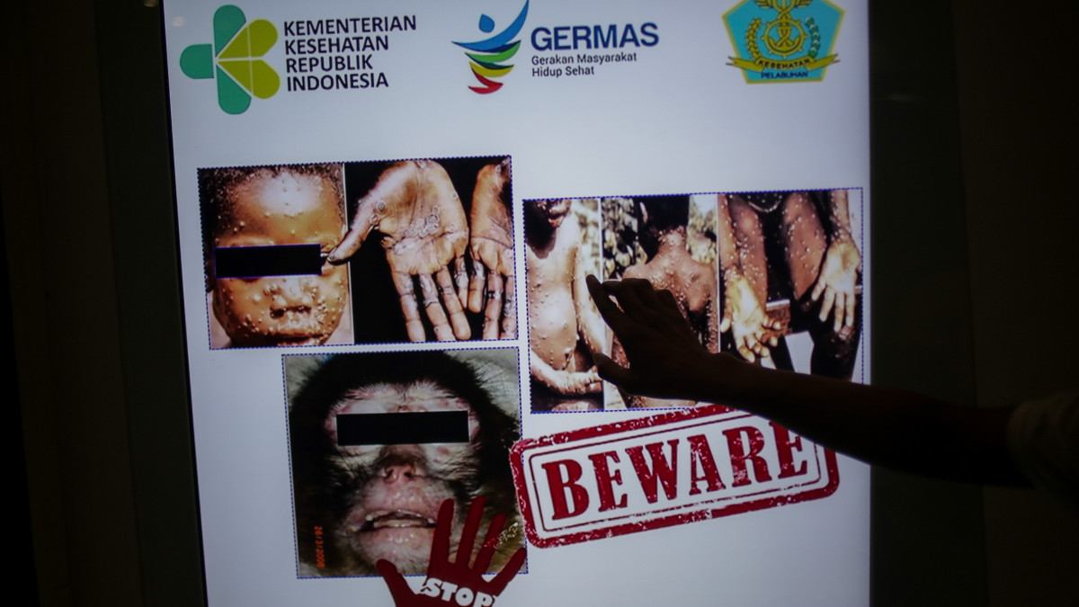 TANGERANG, INDONESIA - MAY 15: A passenger walk in front of a monkeypox virus information at Soekarno-Hatta International Airport in Tangerang near Jakarta, Indonesia on May 15, 2019. Monkeypox is an infectious disease by monkeypox virus endemic from parts of Central and Westerns Africa that make humans lesions, fever, muscle aches and chills. (Photo credit should read Jepayona Delita/Future Publishing via Getty Images)