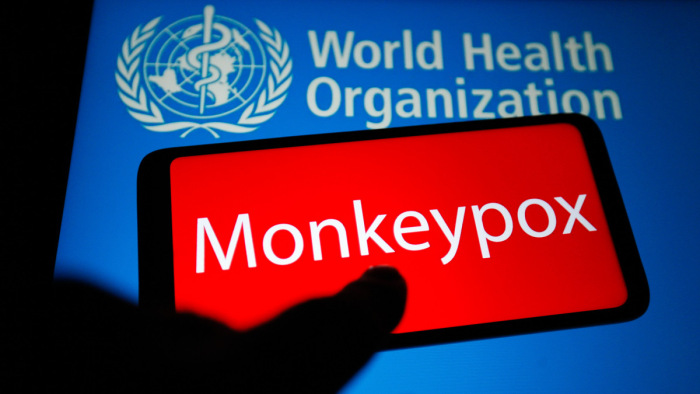 Már 11 országban észleltek majomhimlős megbetegedéseket
