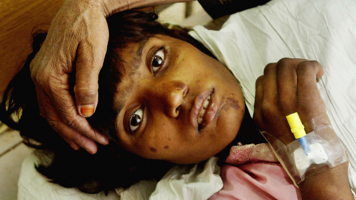 395604 02: Ten-year-old Shafioa, an Afghan refugee girl with cholera, lies in bed October 10, 2001 at Lady Reading hospital in Peshawar, Pakistan, near the border of Afghanistan. Cholera is becoming rampant at refugee camps at the Afghan-Pakistani border, as desparate Afghans try to flee to Pakistan. (Photo by Chris Hondros/Getty Images)