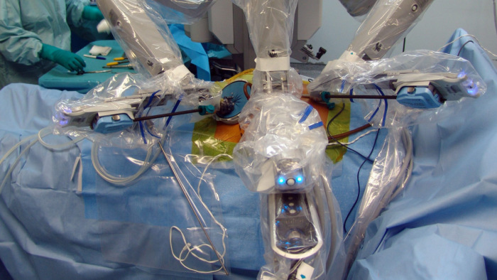 Magyarországon elsőként végeztek robottal tüdőműtétet - videó