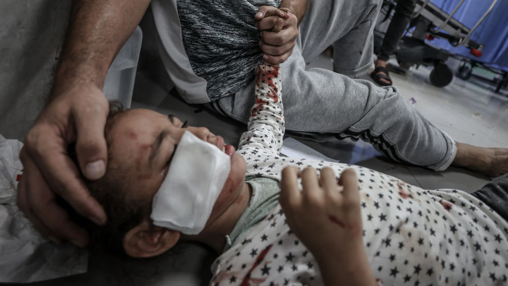GAZA CITY, GAZA - OCTOBER 23: (EDITORS NOTE: Image depicts graphic content) Children injured after Israeli attacks, are taken to Al-Shifa Hospital as Israeli attacks continue on 17th day of clashes in Gaza City, Gaza on October 23, 2023. (Photo by Ali Jadallah/Anadolu via Getty Images)