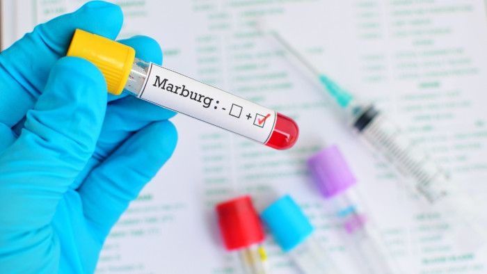 Rusvai Miklós: Európa sincs teljes biztonságban az Ebolához hasonló halálos kórral szemben