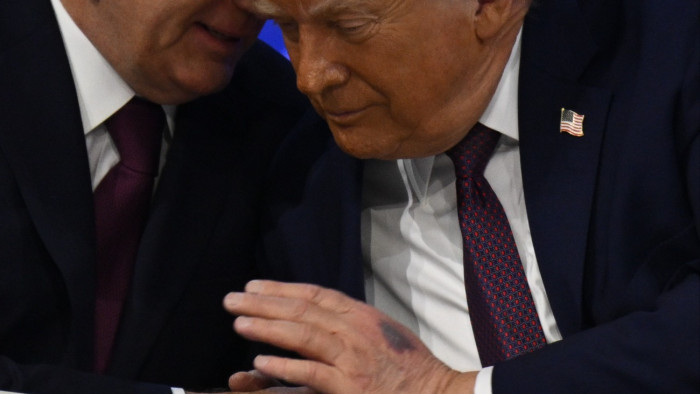 Újrakezdődtek a találgatások, bekékült Donald Trump keze