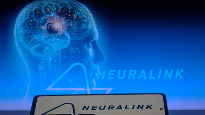 Csodát tett Elon Musk agychipje a lebénult sportolónál